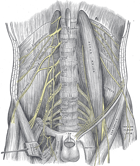 Nerve entrapment by the illio-psoas causing pain, tingling, and